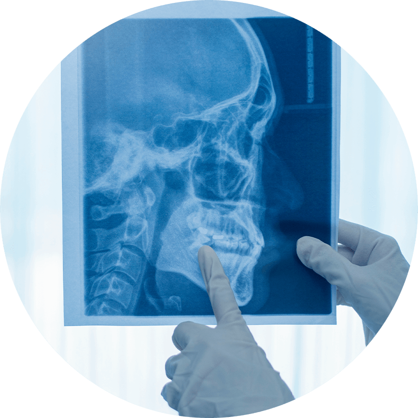 dentist pointing at jaw xray